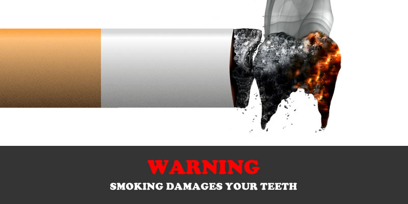 Smoking – How it kills your teeth’s