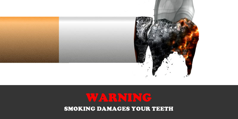 Smoking – How it kills your teeth’s